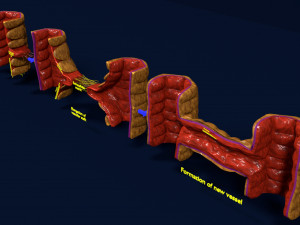 3D Angiogenesis 3D Модель