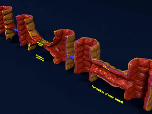 Angiogenesi 3D Modello 3D