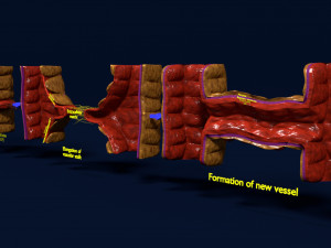 3D Angiogenesis Model 3D