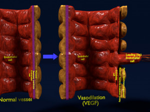 3D Angiogenesis Model 3D