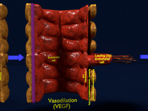 3D Angiogenesis Model 3D