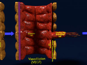 3D Angiogenesis 3D Model