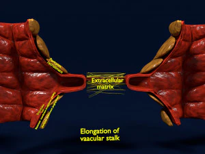 3D Angiogenesis 3D Model