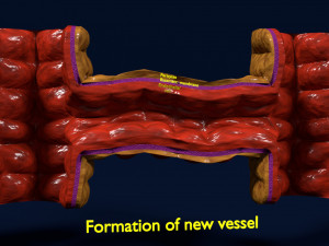 3D Angiogenesis Model 3D