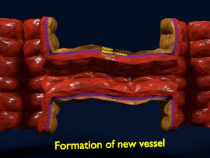 3D Angiogenesis 3D Model