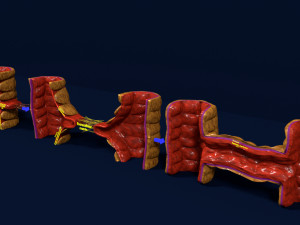 3D Angiogenesis Model 3D