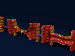 3D Angiogenesis 3D Model