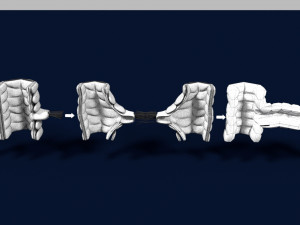 3D Angiogenesis Model 3D