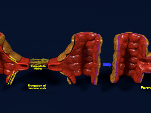 3D Angiogenesis Model 3D