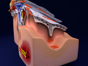 Brain hemorrhage types model Modelo 3D