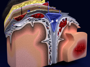 Brain hemorrhage types model Modelo 3D