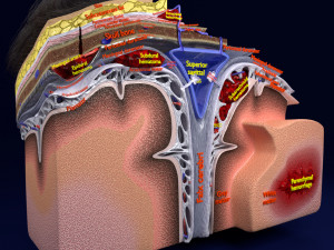 Brain hemorrhage types model Modelo 3D