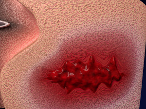 Brain hemorrhage types model Modelo 3D