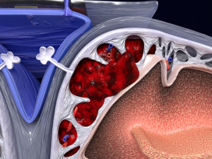 Brain hemorrhage types model Modelo 3D