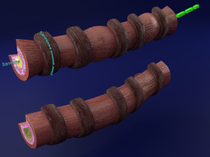3D Asthma bronchiole obstruction model 3D 模型