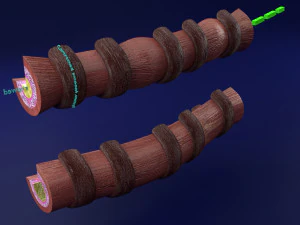 3D Asthma bronchiole obstruction model 3D Model