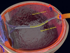 Cataract eye lens types detailed animated 3D Model