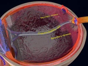 Cataract eye lens types detailed animated 3D Model