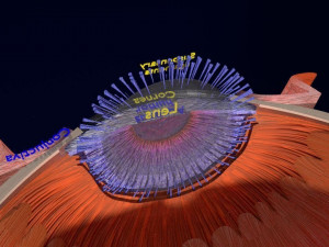 Cataract eye lens types detailed animated 3D Model
