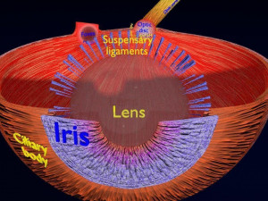 Cataract eye lens types detailed animated 3D Model