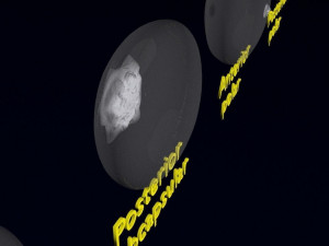 Cataract eye lens types detailed animated 3D Model