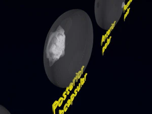 Cataract eye lens types detailed animated 3D Model