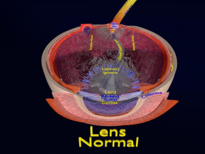 Cataract eye lens types detailed animated 3D Model