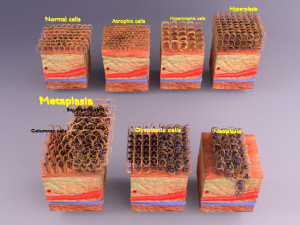 3D cell adaptation 3D-Modell