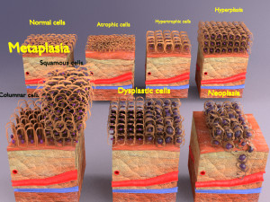 3D cell adaptation 3D-Modell
