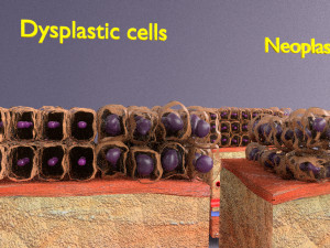 3D cell adaptation 3D-Modell