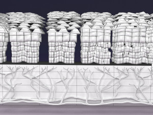 Cervical cancer dysplasia CIN Model 3D