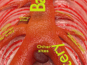 Cerebral aneurysms berry circle of willis Model 3D