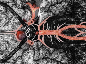 Cerebral aneurysms berry circle of willis Model 3D