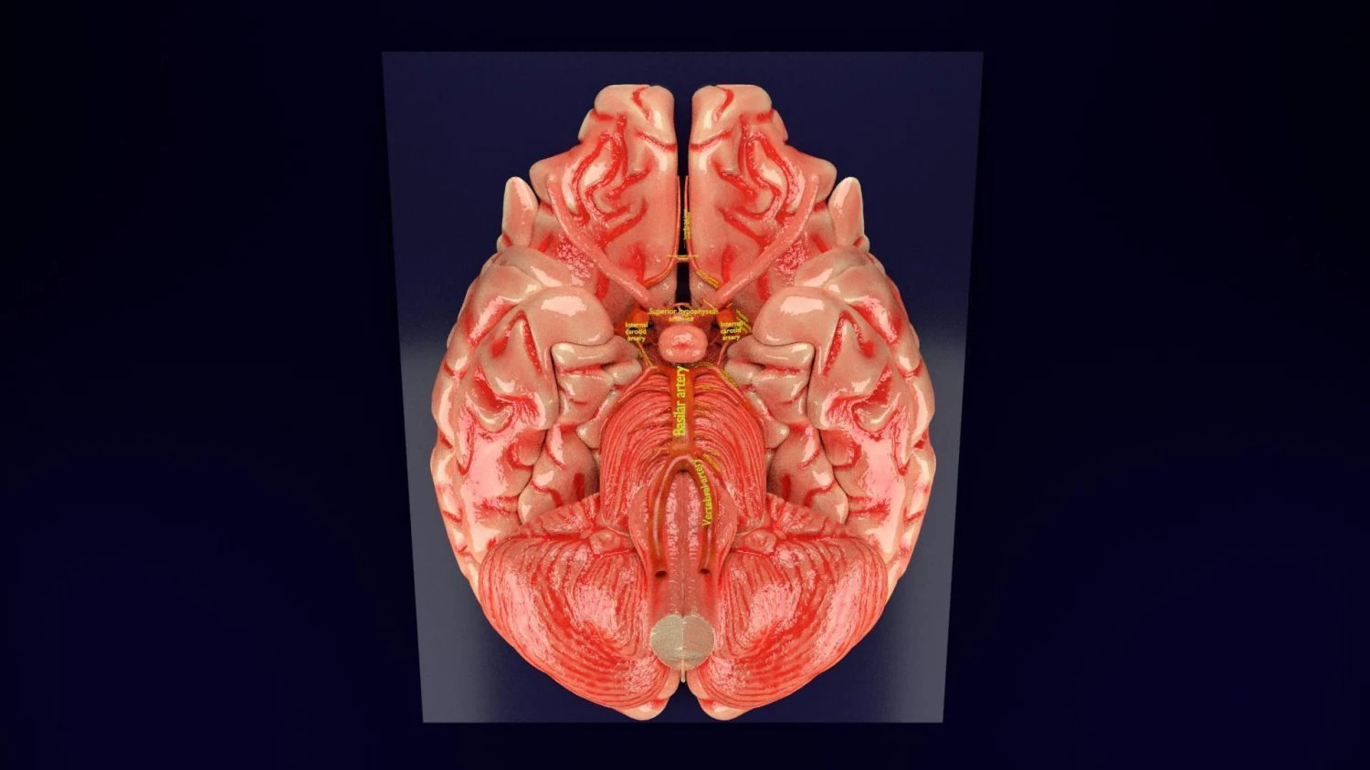 Circle of willis 3D Model .c4d .max .obj .3ds .fbx .stl .blend 