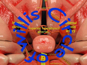 Circle of willis 3D 模型
