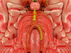 Circle of willis 3D 模型