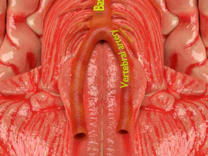 Circle of willis 3D Model