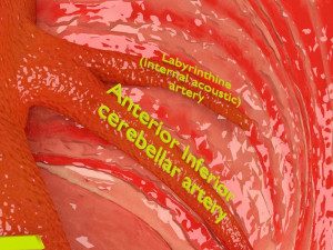 Circle of willis 3D 模型