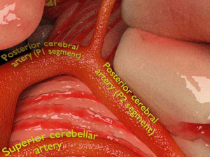Circle of willis 3D 模型