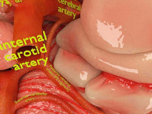 Circle of willis 3D 模型