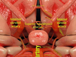 Circle of willis 3D 模型