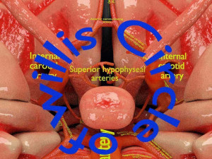 Circle of willis 3D 模型