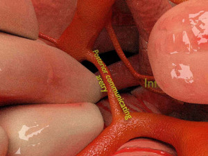 Circle of willis 3D 模型