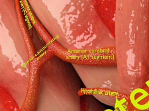 Circle of willis 3D 模型
