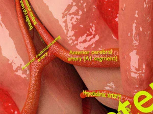 Circle of willis 3D Model