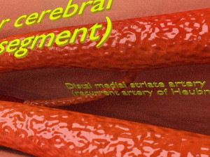 Circle of willis 3D 模型