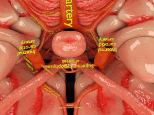 Circle of willis 3D 模型