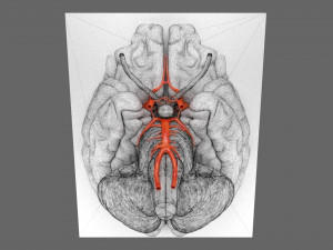Circle of willis 3D 模型