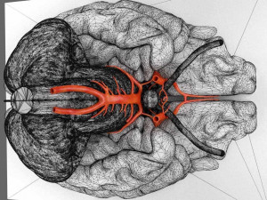Circle of willis 3D 模型