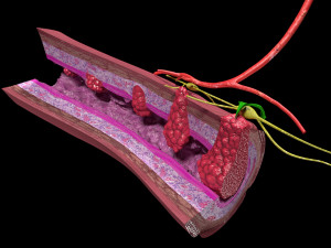 3D Colon cancer staging detail labelled 3D Model